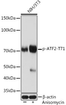 Phospho-ATF2 (Thr71) Antibody in Western Blot (WB)