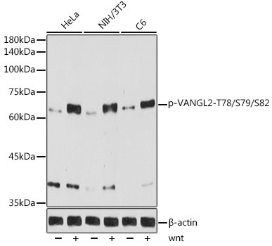 Phospho-VANGL2 (Thr78, Ser79, Ser82) Antibody in Western Blot (WB)