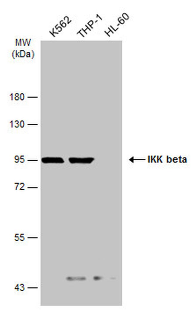 IKK beta Antibody in Western Blot (WB)