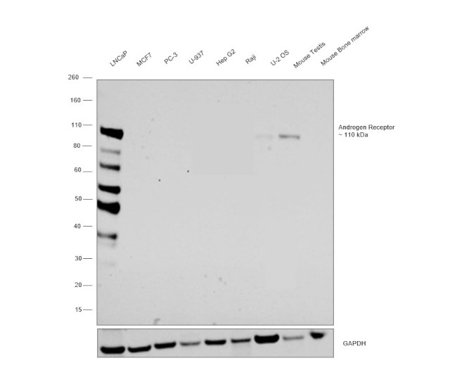 Androgen Receptor Antibody in Western Blot (WB)