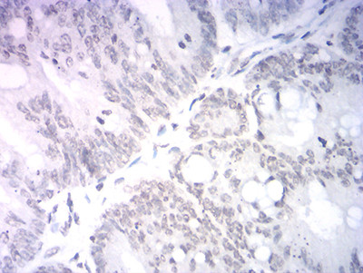 NeuroD1 Antibody in Immunohistochemistry (Paraffin) (IHC (P))