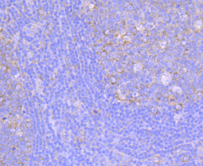 FMRP Antibody in Immunohistochemistry (Paraffin) (IHC (P))