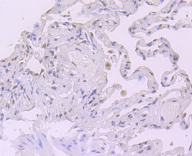 CRM1 Antibody in Immunohistochemistry (Paraffin) (IHC (P))