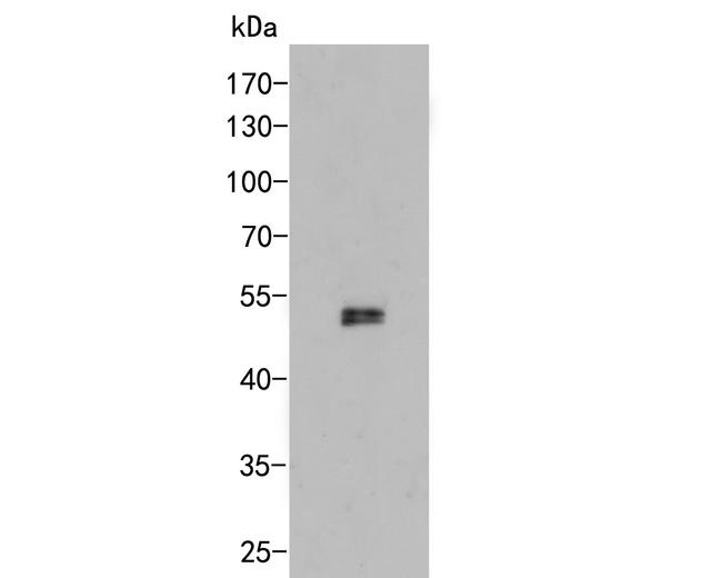 CUG-BP2 Antibody in Western Blot (WB)