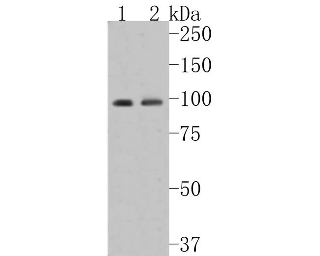 INSR beta Antibody in Western Blot (WB)