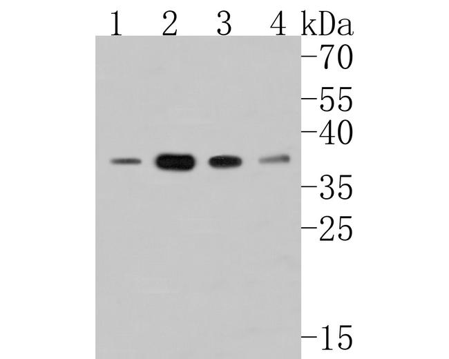 HDGF Antibody in Western Blot (WB)