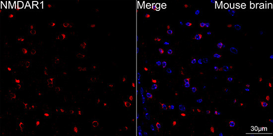 NMDAR1 Antibody in Immunohistochemistry (Paraffin) (IHC (P))