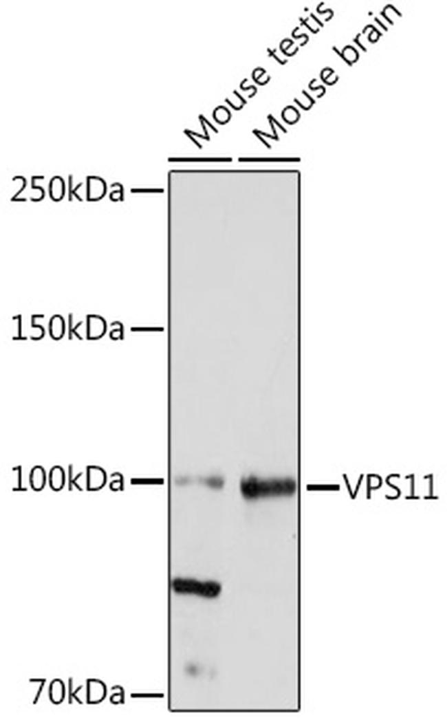 VPS11 Antibody in Western Blot (WB)