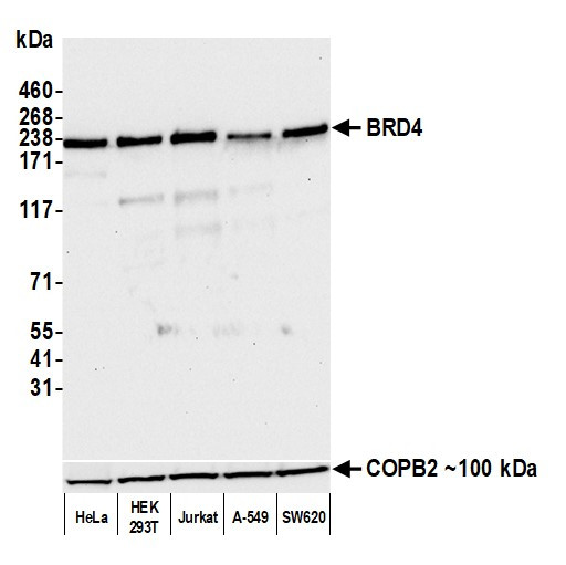 BRD4 Antibody in Western Blot (WB)