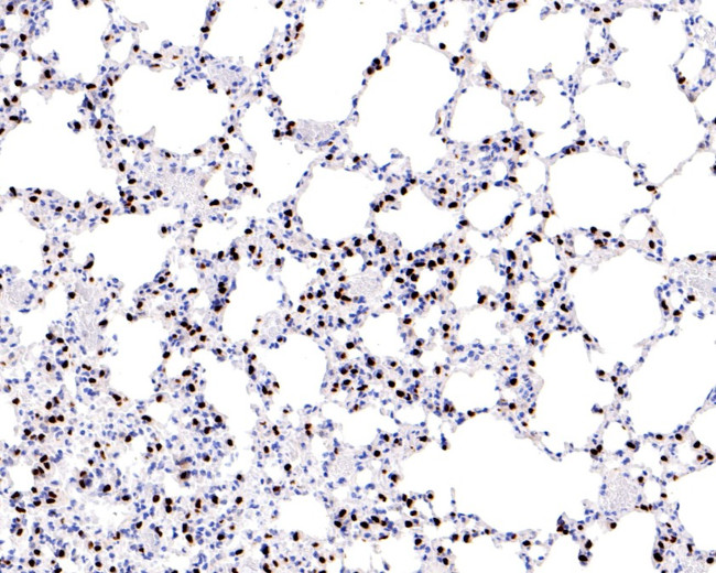Nkx2.1 Antibody in Immunohistochemistry (Paraffin) (IHC (P))