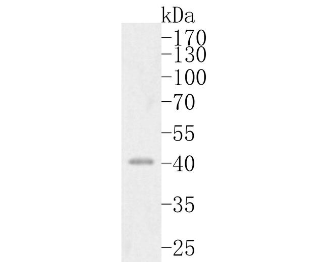 ERLIN2 Antibody in Western Blot (WB)