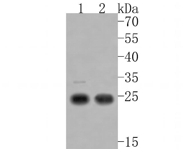 CTR1 Antibody in Western Blot (WB)