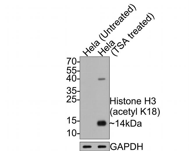 H3K18ac Antibody in Western Blot (WB)