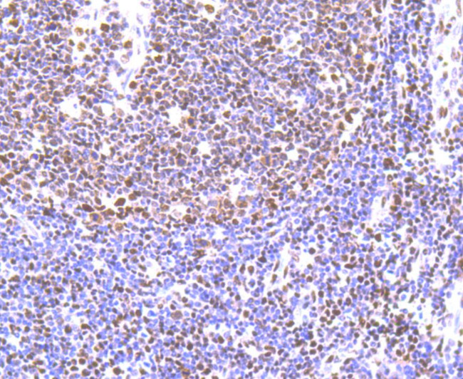 IL-6 Antibody in Immunohistochemistry (Paraffin) (IHC (P))
