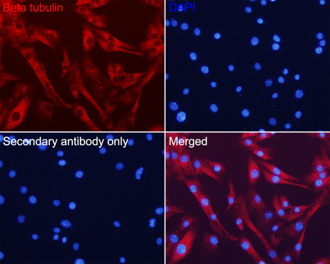 beta Tubulin Antibody in Immunocytochemistry (ICC/IF)