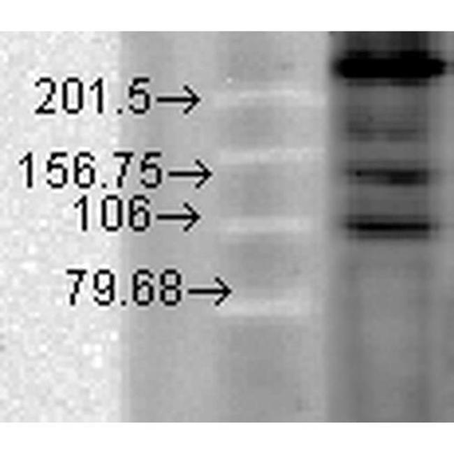 CaV1.2 Antibody in Western Blot (WB)