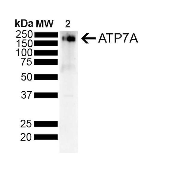 ATP7A Antibody in Western Blot (WB)