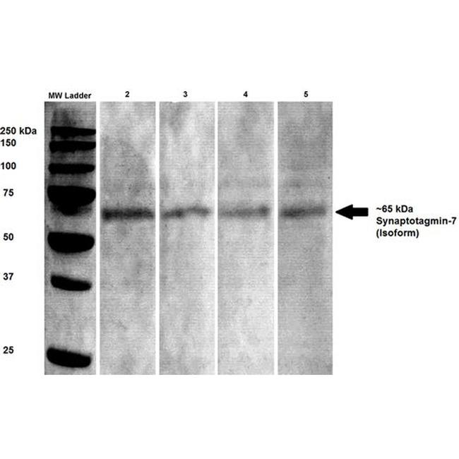 Synaptotagmin 7 Antibody in Western Blot (WB)