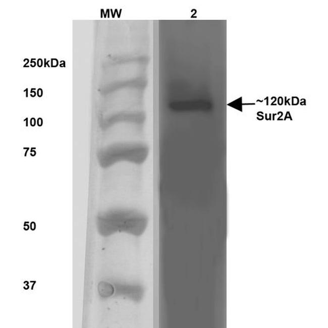 SUR2A Antibody in Western Blot (WB)