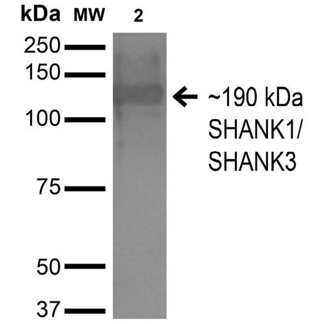 SHANK1/SHANK3 Antibody in Western Blot (WB)