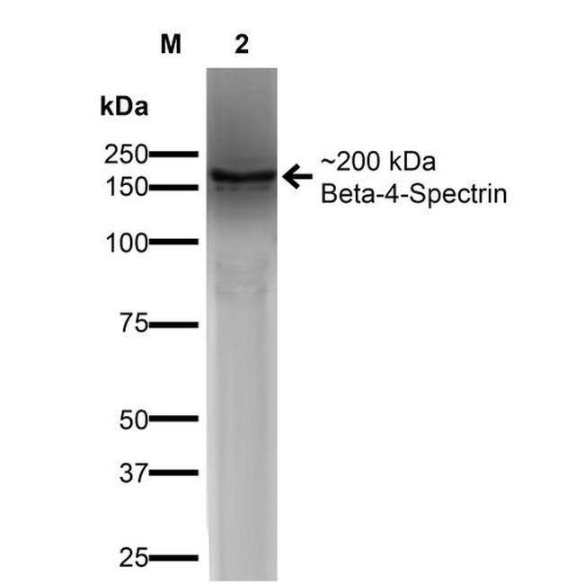 Spectrin beta-4 Antibody in Western Blot (WB)