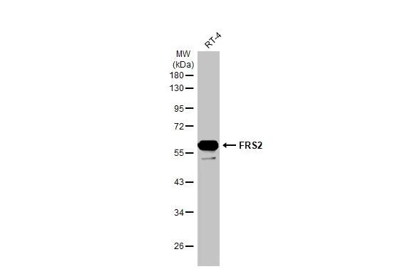 FRS2 Antibody in Western Blot (WB)