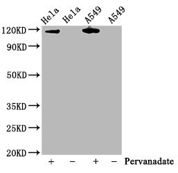 Phospho-JAK2 (Tyr1007, Tyr1008) Antibody in Western Blot (WB)