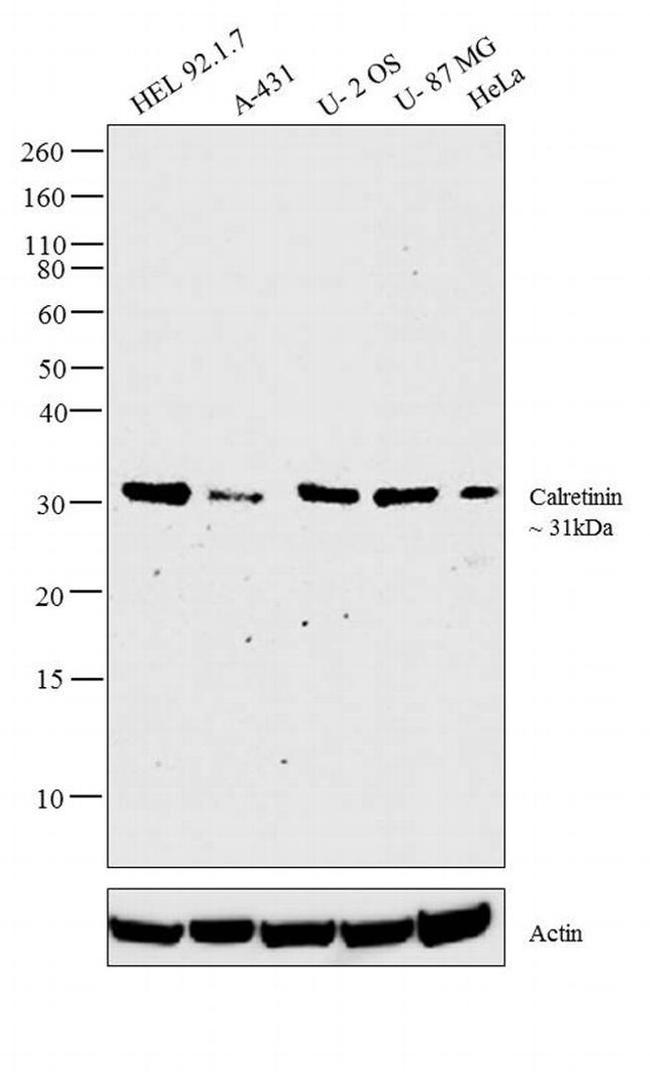 Calretinin Antibody in Western Blot (WB)