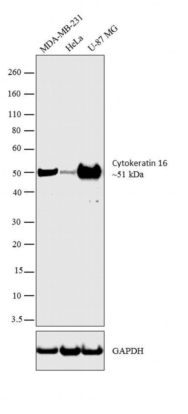 Cytokeratin 16 Antibody in Western Blot (WB)