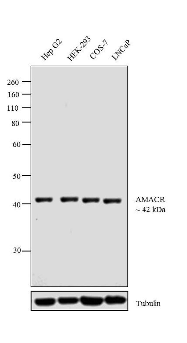 AMACR Antibody in Western Blot (WB)