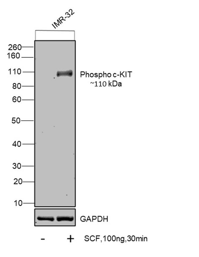 Phospho-c-Kit (Tyr703) Antibody in Western Blot (WB)