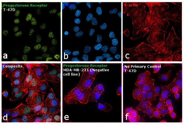 ma5ページ Progesterone Receptor Monoclonal Antibody (R.809.9) (MA5-14842)