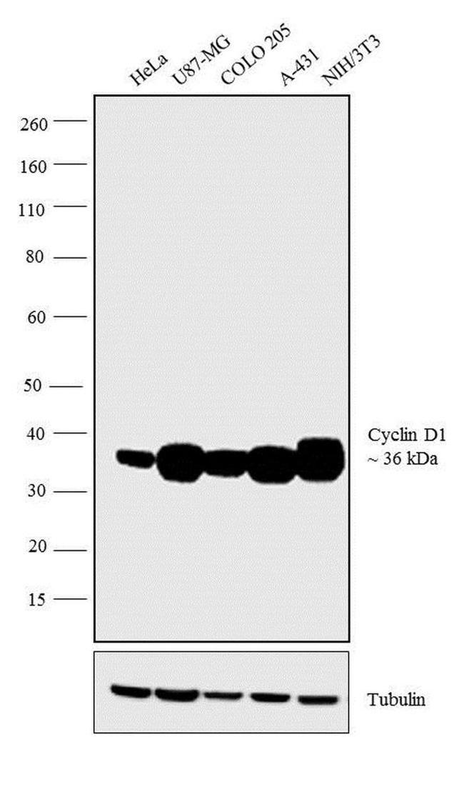 (SP4)　Cyclin　Antibody　D1　Recombinant　Monoclonal　(MA5-16356)