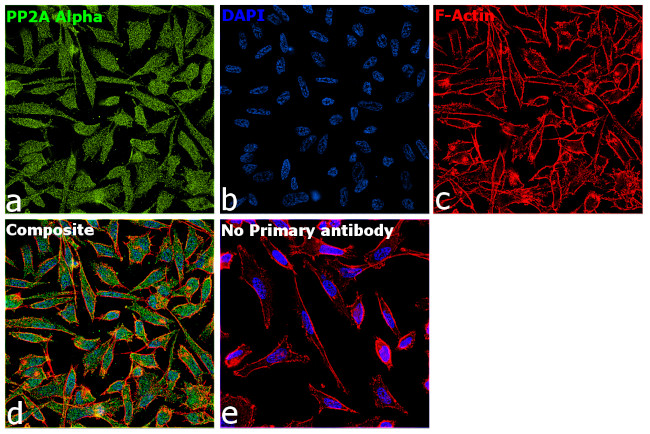 PP2A alpha Antibody in Immunocytochemistry (ICC/IF)
