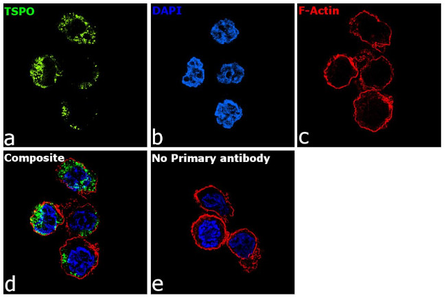 TSPO Antibody in Immunocytochemistry (ICC/IF)