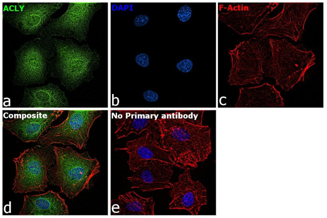 ATP Citrate Lyase Antibody in Immunocytochemistry (ICC/IF)