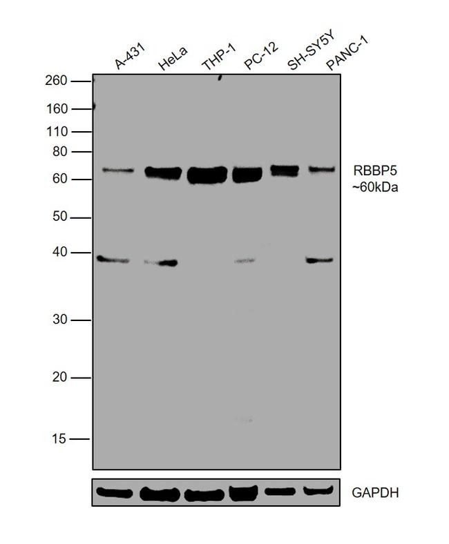 RBBP5 Antibody in Western Blot (WB)