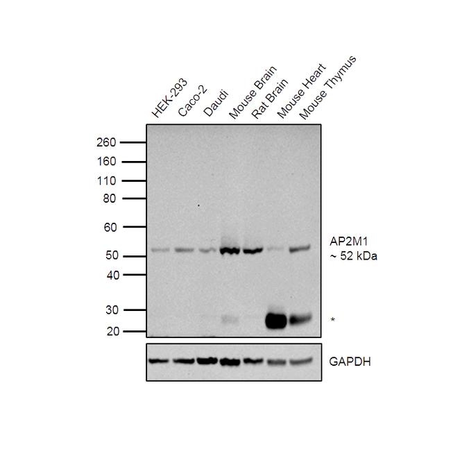 AP2M1 Antibody in Western Blot (WB)