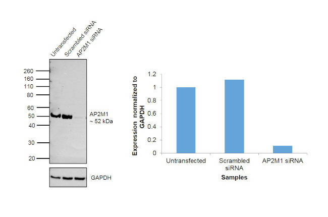 AP2M1 Antibody