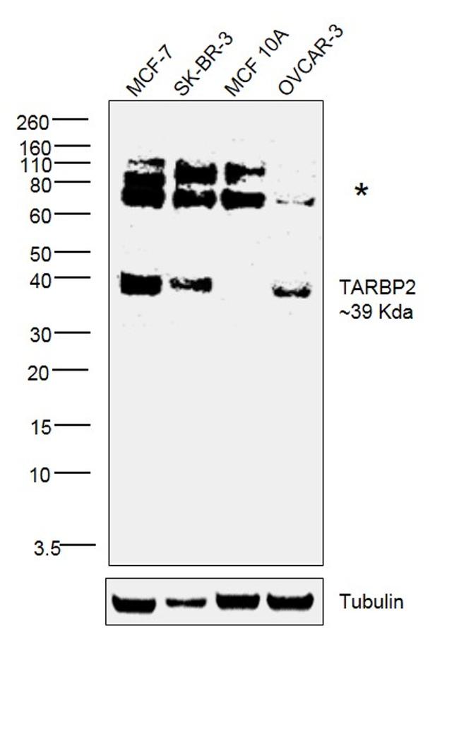 TRBP Antibody in Western Blot (WB)
