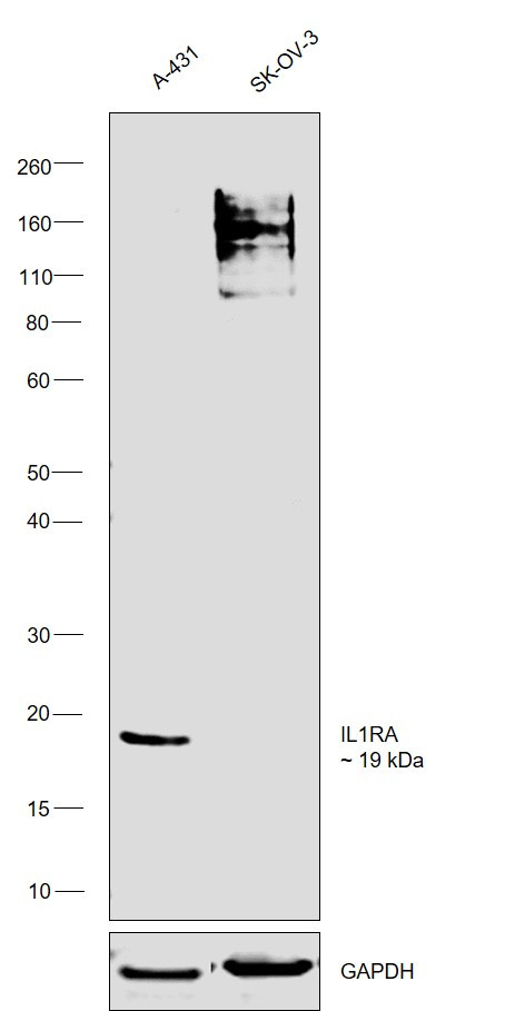 IL1RA Antibody