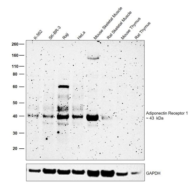 Adiponectin Receptor 1 Antibody in Western Blot (WB)