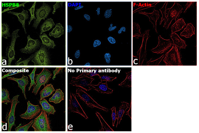 HSPB8 Antibody in Immunocytochemistry (ICC/IF)