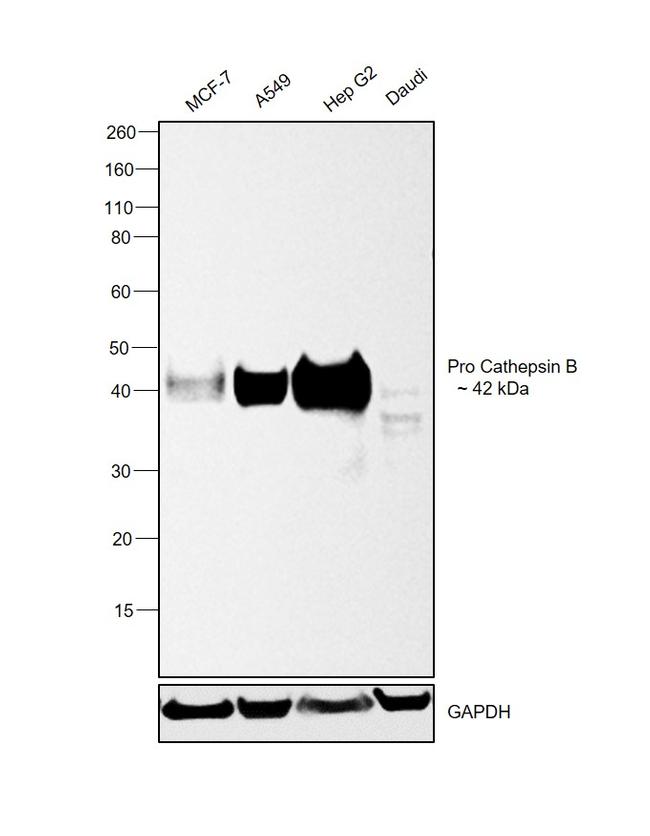 Cathepsin B Antibody in Western Blot (WB)