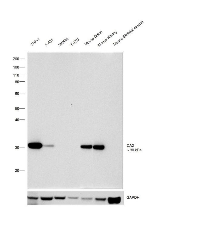 Carbonic anhydrase II Antibody in Western Blot (WB)