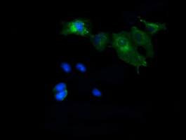 MAP2K1 Antibody in Immunocytochemistry (ICC/IF)