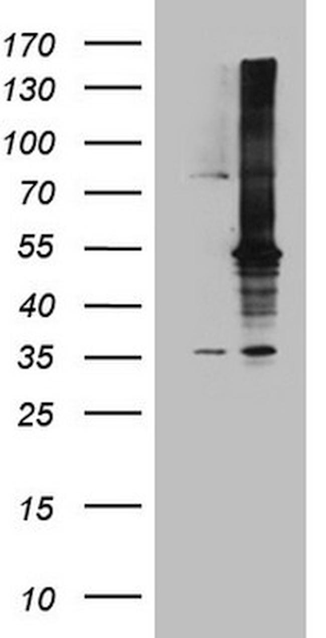 MAP3K8 Antibody in Western Blot (WB)
