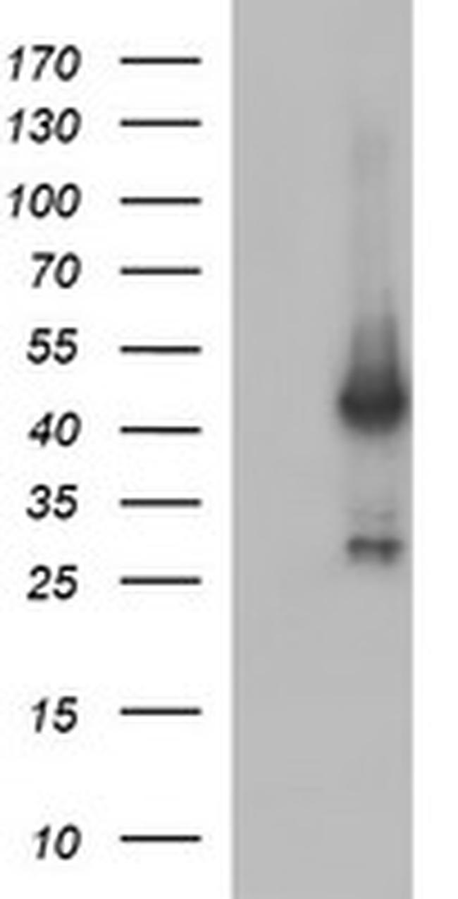 MAPK13 Antibody in Western Blot (WB)