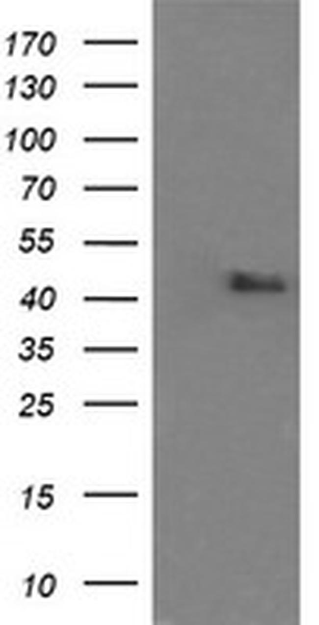 MAPK9 Antibody in Western Blot (WB)