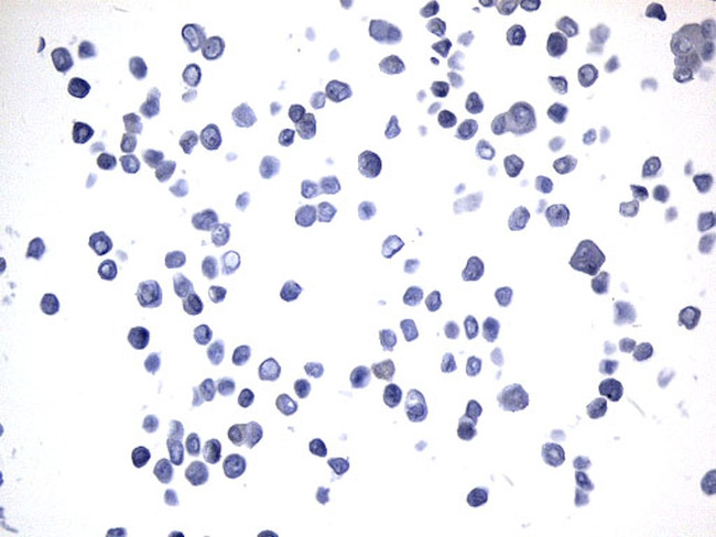 MAPT Antibody in Immunocytochemistry (ICC/IF)